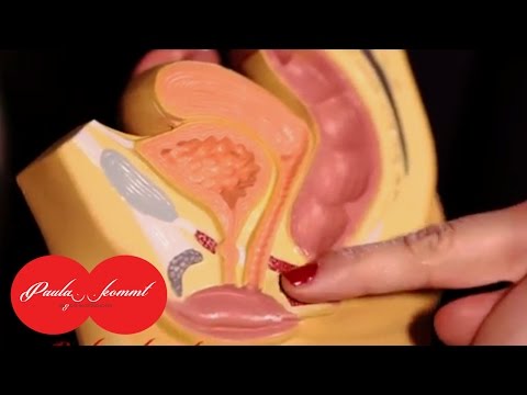Laser mit Prostatitis Prostata-Behandlung mit Knoblauch