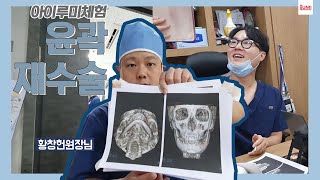 [아이루미체험] #윤곽재수술 고민이라면? 믿.고.가.는 황창헌원장님 ????