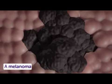 Oral Cancer Treatment - Targeted Therapy