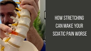 How Stretching Can Make Your Sciatic Pain Worse | w/ Portland Chiropractor Dr. Carl Baird