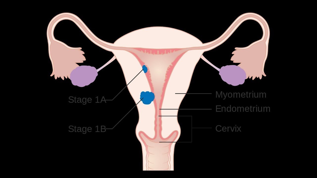 Ciclo menstrual, ovárico y endometrial