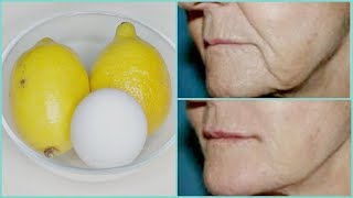 REMOVE WRINKLES, GET INSTANT FACE LIFT NATURALLY, MOUTH WRINKLES, HOMEMADE BOTOX |Khichi Beauty
