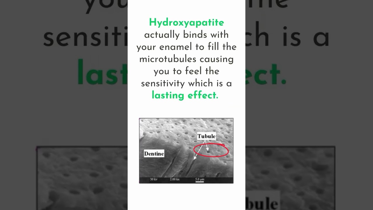 HOW OLLIE FRESH MINT TOOTHPASTE SOLVED MY TOOTH SENSITIVITY!