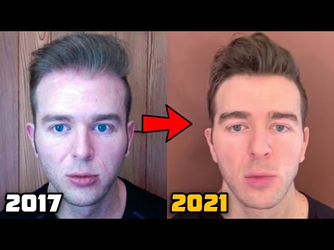 My Current Hair Loss Prevention Protocol