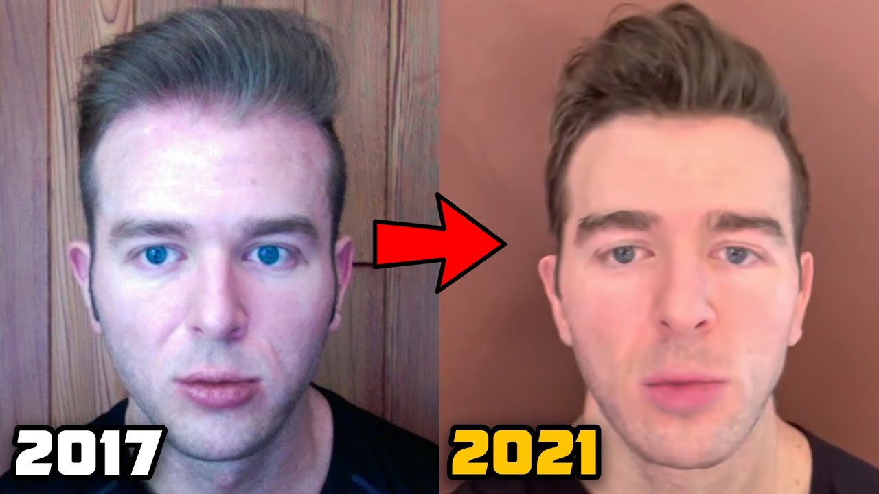 My Current Hair Loss Prevention Protocol