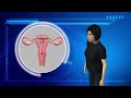 Transgender Women May Soon Be Able To Give Birth
