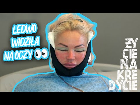 DOBA PO OPERACJI PALSTYCZNEJ❗😮 "PRAWIE CIĘ NIE WIDZĘ" 👀  | Życie na kredycie