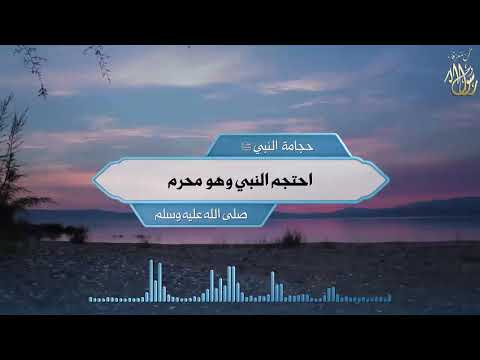 حجامة النبي ﷺ احتجم النبي وهو محرم الشمائل المحمدية