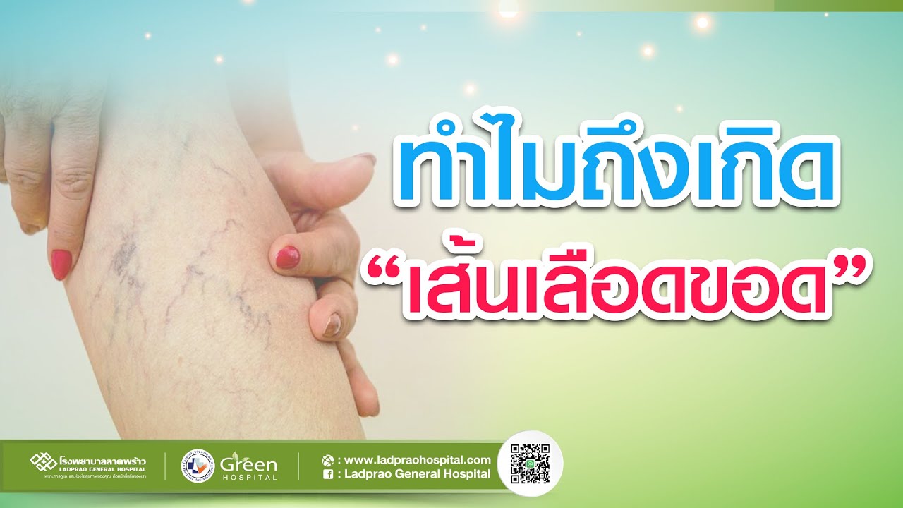 ทำไมถึงเกิด เส้นเลือดขอด