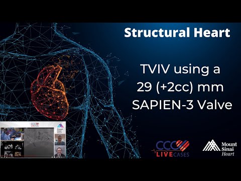 (Edited) TVIV using a 29 (+2cc) mm SAPIEN-3 Valve