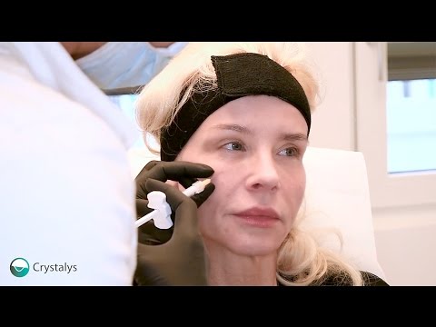 Dr. Natalie Keller - Volumenaufbau und Hautstraffung des Mittelgesichtes