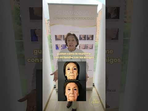 video PsDkaupYDpY