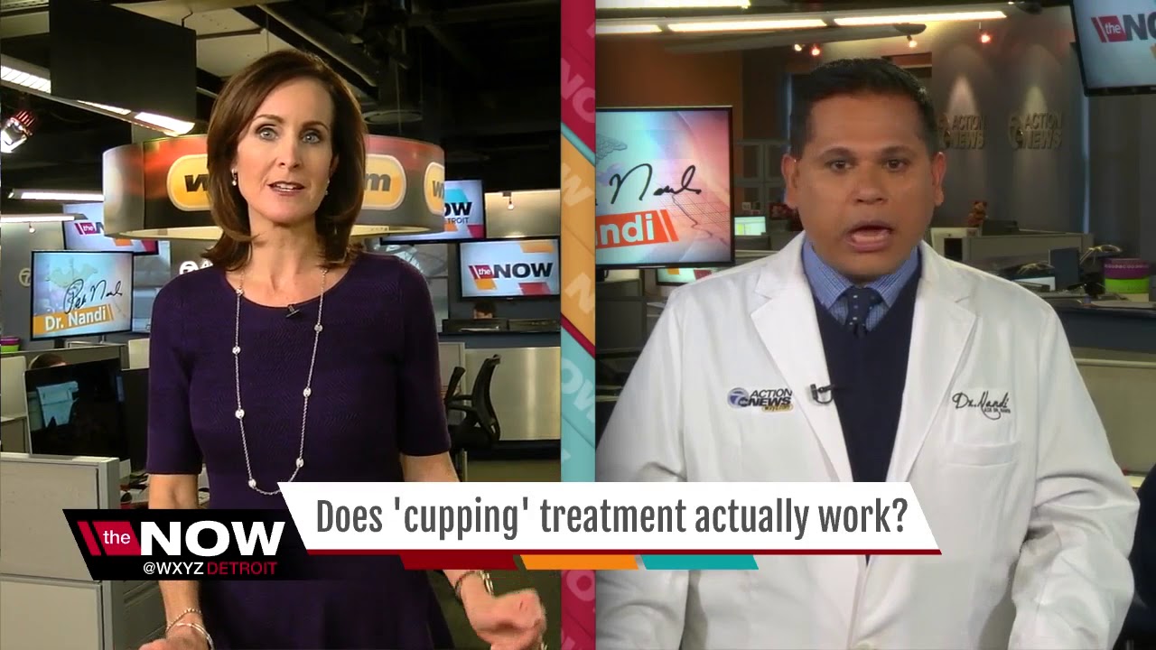 Ask Dr. Nandi: Does 'Cupping' actually work?