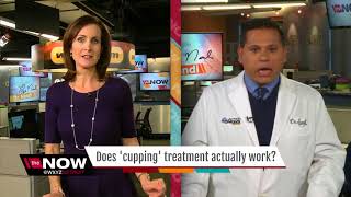 Ask Dr. Nandi: Does 'Cupping' actually work