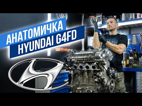 Hyundai/Kia G4FD 1.6 GDI Недуг налицо