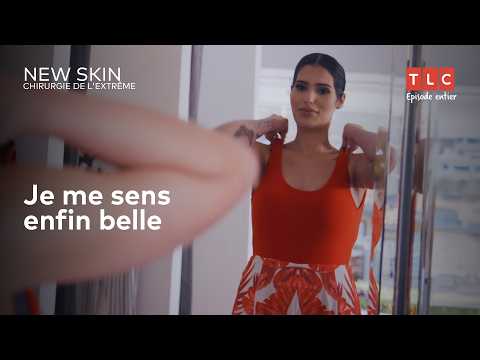 Abdominoplastie Extrême _ NEW SKIN