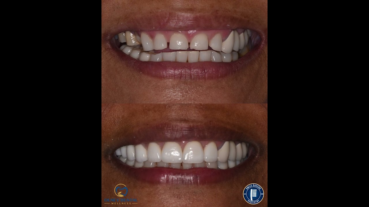 Smile Gallery Video 9