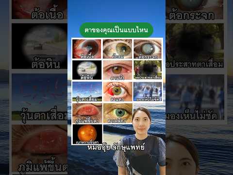ตาไหนที่ตรงกับตาของคุณ #หมออุ๊ย #goodeyes #จักษุแพทย์ #โรคตา #ดวงตา #ต้อหิน #ต้อลม #ต้อกระจก