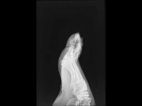 Toes X-Ray in Motion