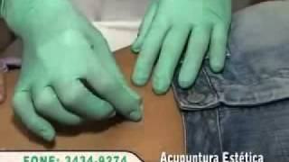 ACUPUNTURA ESTÉTICA CURITIBA - Acupuntura Estética Sem Agulhas