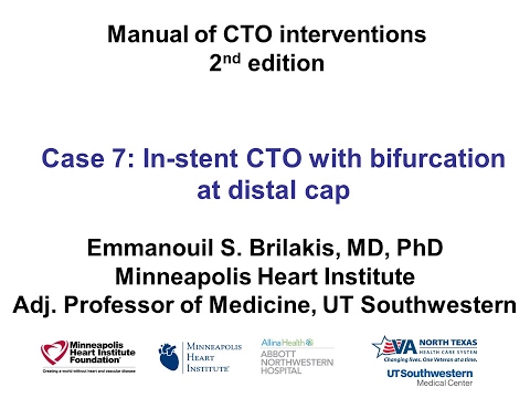 Case 7: Manual of CTO Interventions - In-stent CTO with bifurcation at the distal cap
