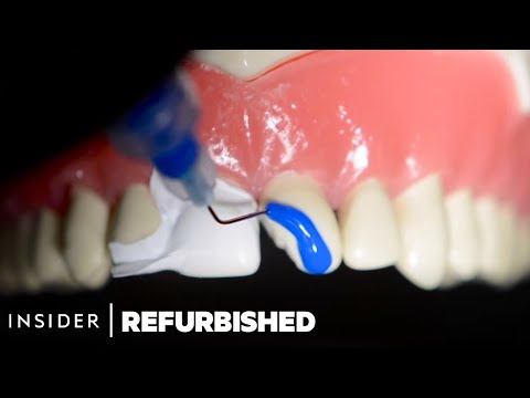 How Damaged Teeth Are Professionally Restored | Refurbished | Insider