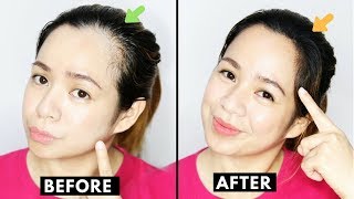 How To Naturally Grow Back Thinning Hairline & Cover up Receding Hairline-Beautyklove