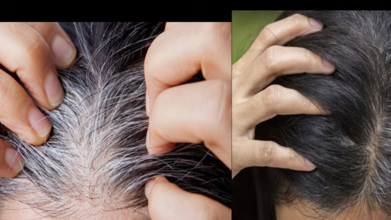 ACABE COM OS CABELOS BRANCOS COM APENAS  4 MINUTOS