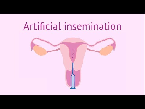 Artificial insemination (AI): What is it and how much does it cost?