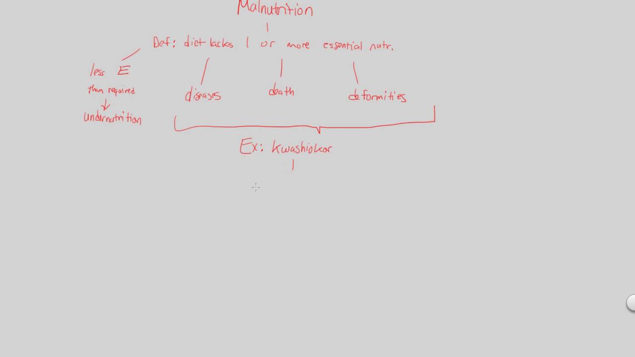 Nutrition - Malnutrition | BIALIGY.com