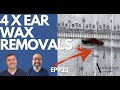 4 x EAR WAX REMOVALS (INC BIG EAR WAX PLUG) - EP923