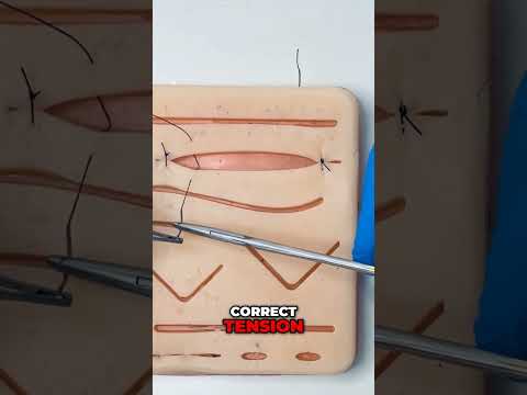 Your Suture Knot Will NEVER Loosen