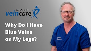 Why Do I Have Blue Veins on My Legs?