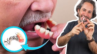 📌PROTESIS METALICAS DENTALES (Esqueleticos) : Superiores e Inferiores (𝐕𝐞𝐧𝐭𝐚𝐣𝐚𝐬 𝐲 𝐃𝐞𝐬𝐯𝐞𝐧𝐭𝐚𝐣𝐚𝐬)