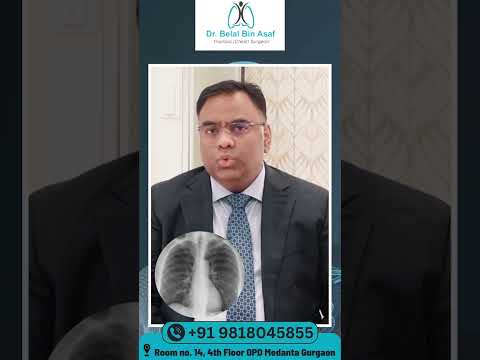 Lung Cancer Diagnosis - Dr. Belal Bin Asaf