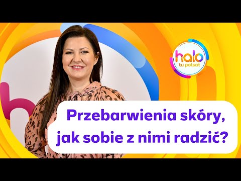 Przebarwienia skóry po wakacjach, jak sobie z nimi radzić? | halo tu polsat