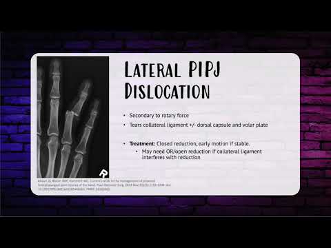 Episode 21: ISR Hand Fractures and Dislocation