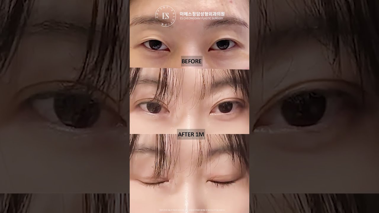 이에스 유튜브