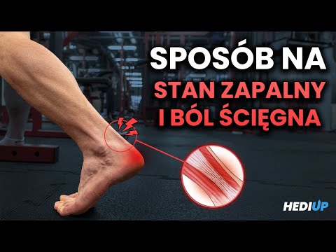 Zapalenie Ścięgna Achillesa - Co Robić Gdy Boli?
