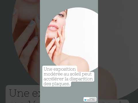 Vidéo : pityriasis rosé de Gibert expliqué par le dermatologue