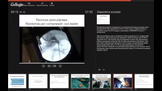 Neuralgia del trigémino