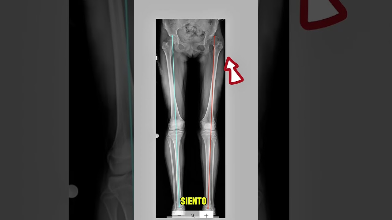 Ruben Sosa Arauco-15