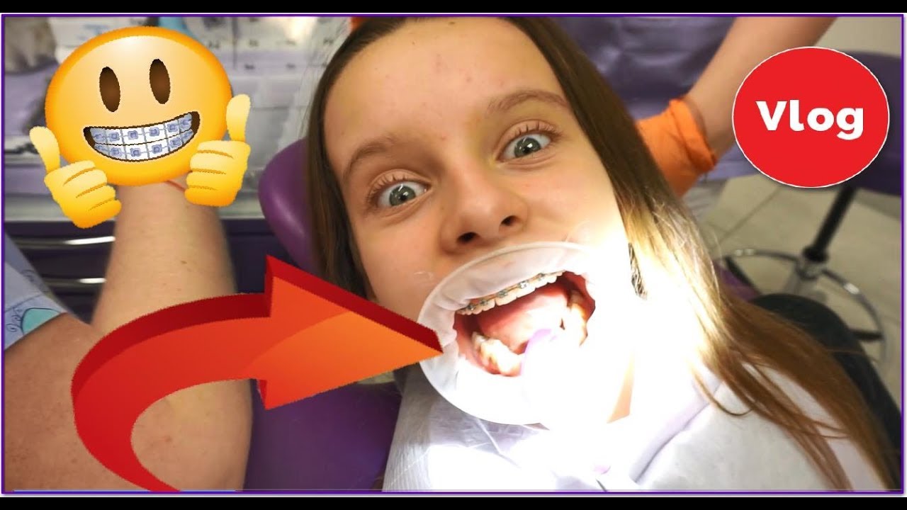 MÓJ NOWY APARAT NA ZĘBY - wizyta u ortodonty - VLOG / Amelie