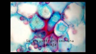 Chevelle - Brainiac [Subtitulado al Español]