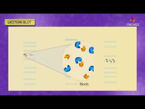 Western blot , Southern blot , Northern blot , South western Blot - Animation