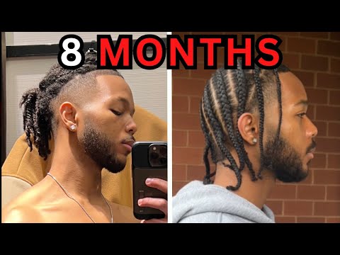 How To Grow Out Your Sides (8 Month Undercut Journey)
