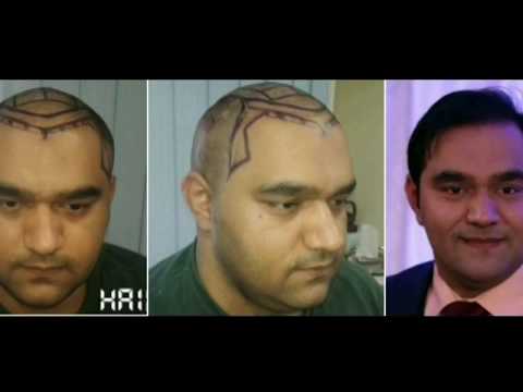 Hai - Dr. zahid Iqbal & Dr. Fraz Akhtar