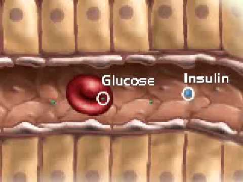 Kräuter Blutzucker zu senken Probleme mit Diabetes
