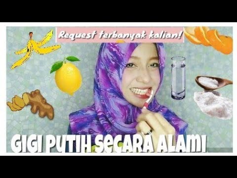 Cara Memutihkan Gigi Alami Cepat Mudah, artikel Cara Memutihkan Gigi Alami Cepat Mudah gratis, video trending Cara Memutihkan Gigi Alami Cepat Mudah