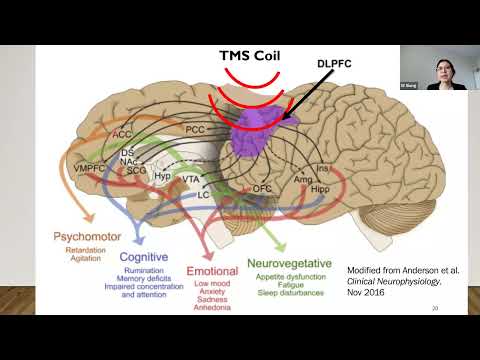 Transcranial Magnetic Stimulation for Treatment-Resistant Depression